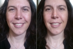 Результат применения крема Instantly Ageless - до и после