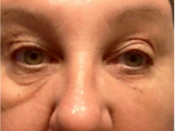 instantly-ageless-photo-before-and-after-4