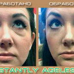instantly-ageless-before-and-after-dark-circles-and-puffiness