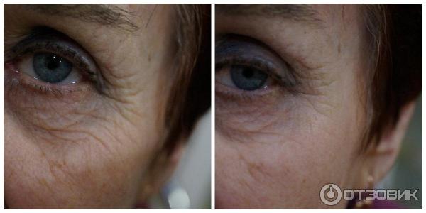 instantly-ageless-effect-woman
