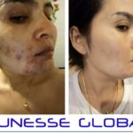 LUMINESCE™ Cellular Rejuvenation Serum - before and after