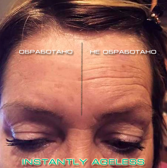 Instantly-Ageless-before-and-after