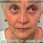 Jeunesse Global's cream effect (before and after)